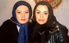 تغییر چهره نگار فروزنده در «دایناسور» سوژه شد!
