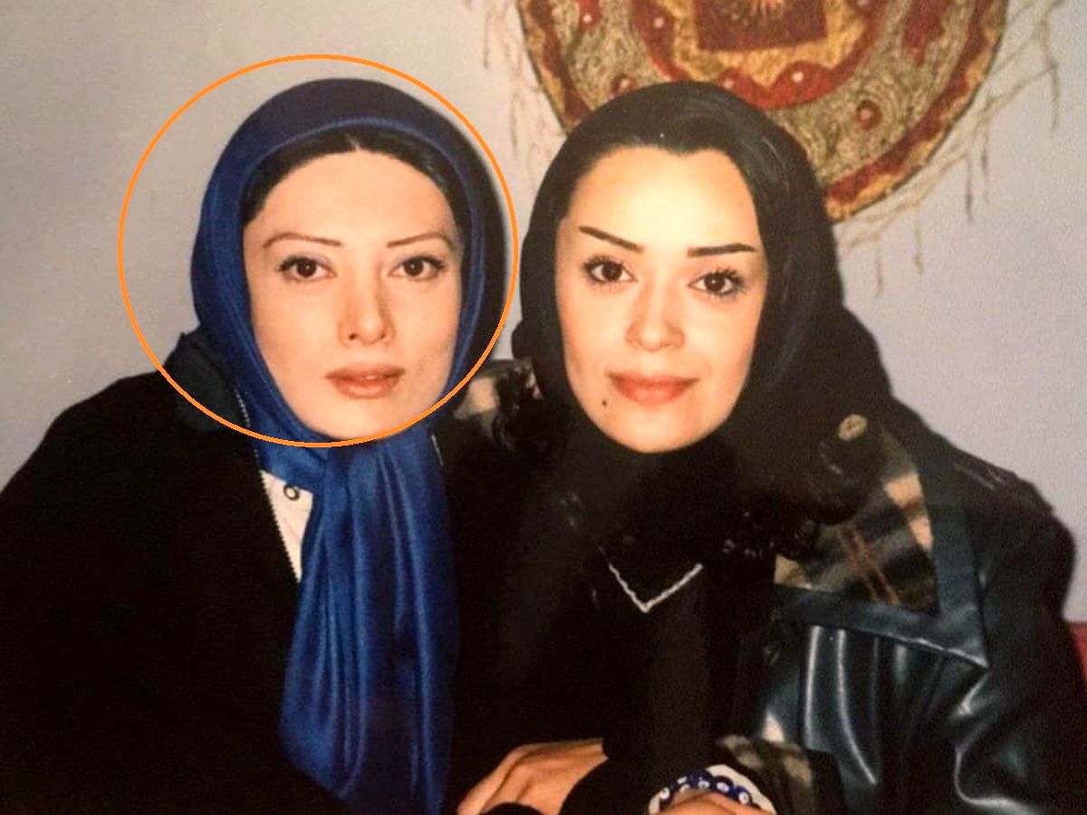 تغییر چهره نگار فروزنده در «دایناسور» سوژه شد!
