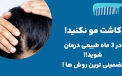 روش های جایگزین کاشت مو