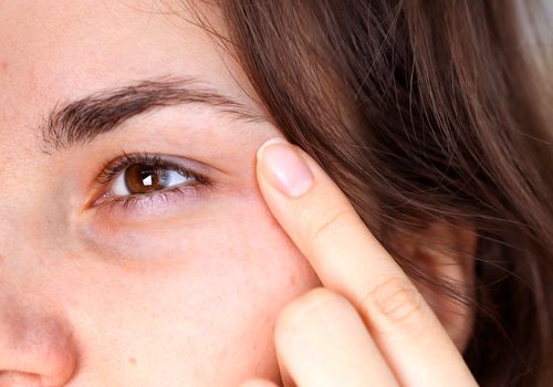 درمان خانگی: چرا با این همه روتین پوستی، بازم دور چشم‌هام سیاهه؟!