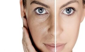 روشن شدن پوست صورت: علل تیرگی و روش‌های درمان